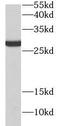 CD151 Molecule (Raph Blood Group) antibody, FNab09920, FineTest, Western Blot image 