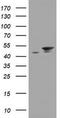 Epoxide Hydrolase 1 antibody, CF800418, Origene, Western Blot image 