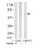 LIM Domain Kinase 1 antibody, ab38508, Abcam, Western Blot image 
