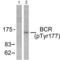 BCR Activator Of RhoGEF And GTPase antibody, LS-C826150, Lifespan Biosciences, Western Blot image 