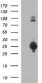 MHC class II-associated invariant chain antibody, TA507339, Origene, Western Blot image 