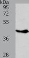 NFKB Inhibitor Epsilon antibody, TA322728, Origene, Western Blot image 