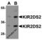 Killer cell immunoglobulin-like receptor 2DS2 antibody, 8201, ProSci, Western Blot image 