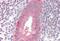 HK II antibody, MBS249204, MyBioSource, Immunohistochemistry paraffin image 