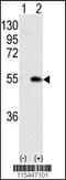 Calcium/Calmodulin Dependent Protein Kinase IG antibody, 62-764, ProSci, Western Blot image 