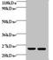 Retinol Binding Protein 4 antibody, A54045-100, Epigentek, Western Blot image 