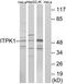 Inositol-tetrakisphosphate 1-kinase antibody, TA314101, Origene, Western Blot image 