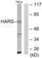 Histidyl-TRNA Synthetase antibody, abx013385, Abbexa, Western Blot image 