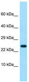Interleukin 19 antibody, TA343359, Origene, Western Blot image 