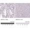Aldo-Keto Reductase Family 1 Member E2 antibody, NBP1-90195, Novus Biologicals, Immunohistochemistry paraffin image 