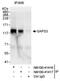 Protein Phosphatase 6 Regulatory Subunit 3 antibody, NB100-41416, Novus Biologicals, Western Blot image 