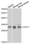 Glutathione S-Transferase Theta 1 antibody, A1287, ABclonal Technology, Western Blot image 