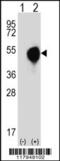 Decapping Exoribonuclease antibody, 62-371, ProSci, Western Blot image 