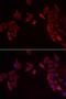 Receptor activity-modifying protein 3 antibody, LS-B15600, Lifespan Biosciences, Immunofluorescence image 