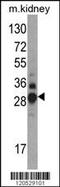 Dimethylarginine Dimethylaminohydrolase 1 antibody, TA324755, Origene, Western Blot image 