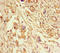 ERLIN2 antibody, LS-C677837, Lifespan Biosciences, Immunohistochemistry paraffin image 