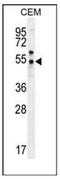 Putative N-acetylated-alpha-linked acidic dipeptidase antibody, AP53485PU-N, Origene, Western Blot image 