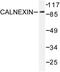 Calnexin antibody, LS-C176314, Lifespan Biosciences, Western Blot image 