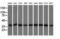 Sterol O-Acyltransferase 2 antibody, LS-C115243, Lifespan Biosciences, Western Blot image 