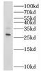 RAB20, Member RAS Oncogene Family antibody, FNab07003, FineTest, Western Blot image 