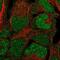 BRCA2 And CDKN1A Interacting Protein antibody, NBP2-55218, Novus Biologicals, Immunofluorescence image 