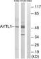 Lysophosphatidylcholine Acyltransferase 2 antibody, TA315552, Origene, Western Blot image 