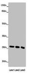 N-Ribosyldihydronicotinamide:Quinone Reductase 2 antibody, orb351177, Biorbyt, Western Blot image 