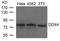 DEAD-Box Helicase 4 antibody, 79-754, ProSci, Western Blot image 