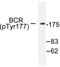 BCR Activator Of RhoGEF And GTPase antibody, LS-C177879, Lifespan Biosciences, Western Blot image 