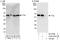 TELO2 Interacting Protein 2 antibody, A303-476A, Bethyl Labs, Immunoprecipitation image 