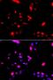 Cullin 4A antibody, LS-B12903, Lifespan Biosciences, Immunofluorescence image 