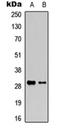 Granzyme K antibody, orb315787, Biorbyt, Western Blot image 