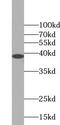Ubiquitin C-Terminal Hydrolase L5 antibody, FNab09220, FineTest, Western Blot image 