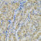 Corticosteroid-binding globulin antibody, 15-102, ProSci, Immunohistochemistry paraffin image 
