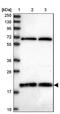 Ring Finger Protein 181 antibody, NBP2-13240, Novus Biologicals, Western Blot image 