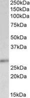 Cyclin Dependent Kinase Inhibitor 1B antibody, MBS421409, MyBioSource, Western Blot image 