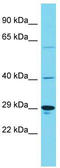 Major Facilitator Superfamily Domain Containing 4B antibody, TA331610, Origene, Western Blot image 