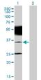 Proline-rich transmembrane protein 2 antibody, H00112476-B01P, Novus Biologicals, Western Blot image 