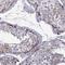 Cancer/Testis Antigen Family 47 Member A9 antibody, HPA042483, Atlas Antibodies, Immunohistochemistry frozen image 