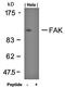 Protein Tyrosine Kinase 2 antibody, orb14551, Biorbyt, Western Blot image 