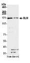 BLM RecQ Like Helicase antibody, A300-110A, Bethyl Labs, Western Blot image 