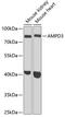 Adenosine Monophosphate Deaminase 3 antibody, GTX30046, GeneTex, Western Blot image 