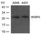 Cellular Communication Network Factor 5 antibody, GTX50849, GeneTex, Western Blot image 