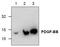 Platelet Derived Growth Factor Subunit B antibody, TA319092, Origene, Western Blot image 