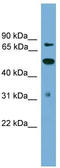 Tousled Like Kinase 2 antibody, TA344372, Origene, Western Blot image 