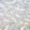 Threonyl-TRNA Synthetase antibody, LS-C334979, Lifespan Biosciences, Immunohistochemistry frozen image 