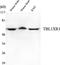 Transducin Beta Like 1 X-Linked Receptor 1 antibody, STJ98558, St John