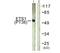 ETS Proto-Oncogene 1, Transcription Factor antibody, AP55698PU-S, Origene, Western Blot image 