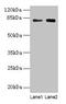 Mannan Binding Lectin Serine Peptidase 1 antibody, LS-B15153, Lifespan Biosciences, Western Blot image 