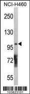 Diacylglycerol Kinase Theta antibody, 63-405, ProSci, Western Blot image 
